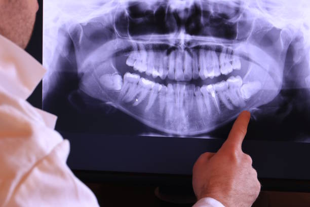 Best Emergency Dental Surgery in East St Louis, IL
