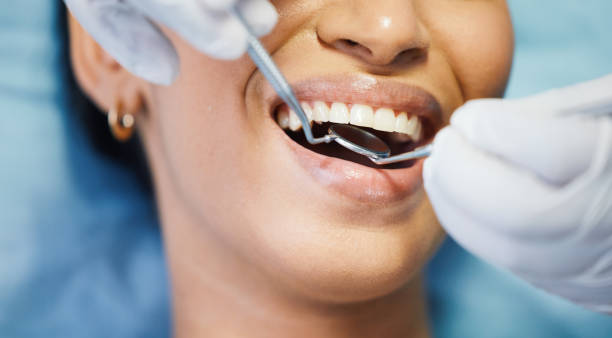 Best Emergency Treatment for Toothache in East St Louis, IL